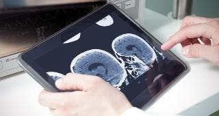 Doctor looking at brain scans © sfam_photo/Shutterstock.com