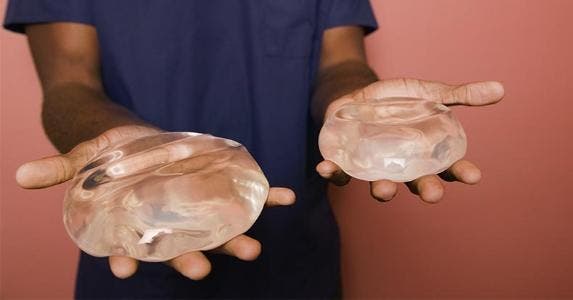 Breast Implant Cost 93