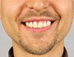 Facial hair © Trofimov Denis/Shutterstock.com